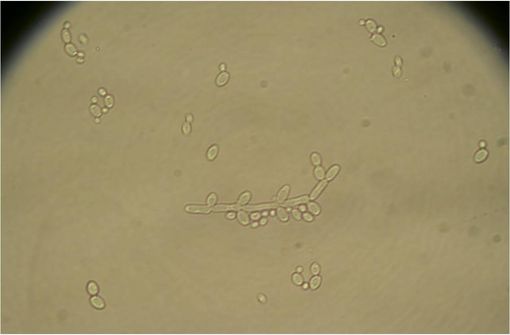 Fluconazole France