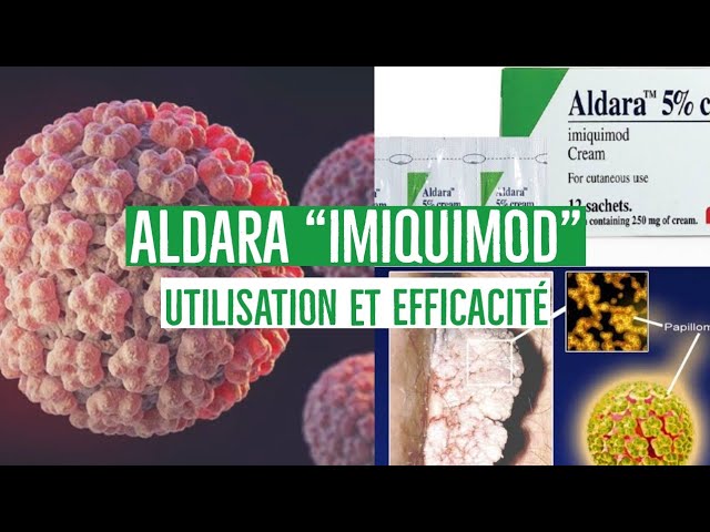 Aldara Online Acheter