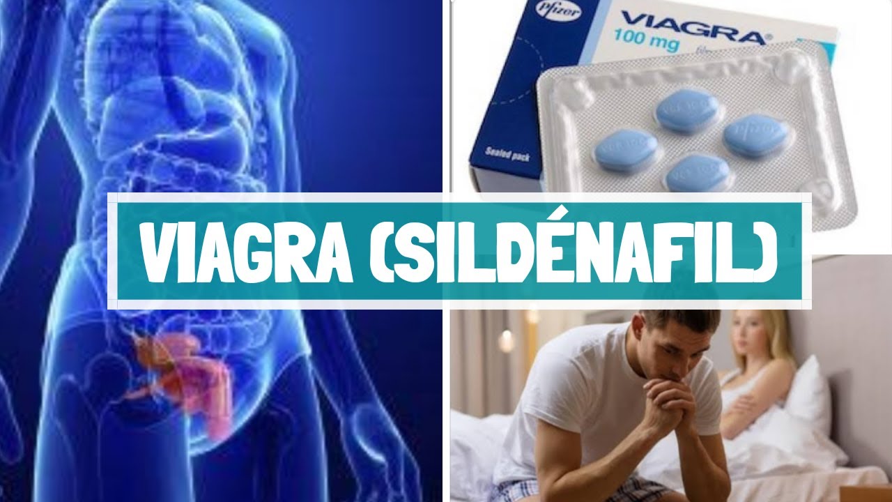 Kamagra 120mg