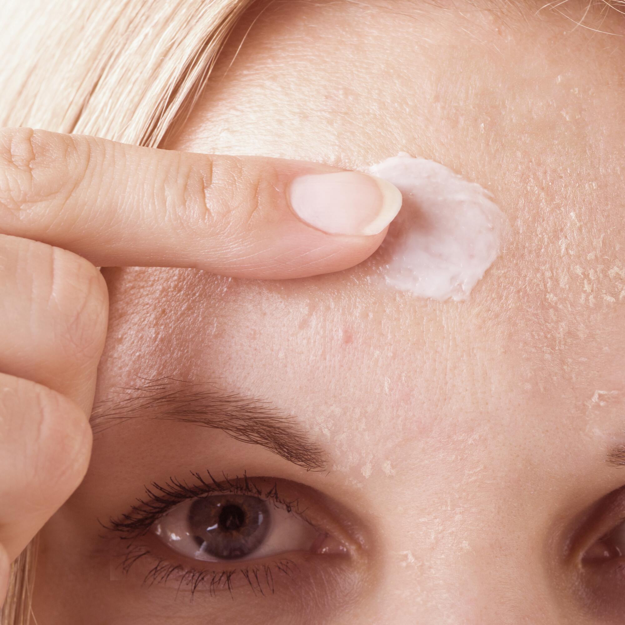 Où Acheter Du Accutane