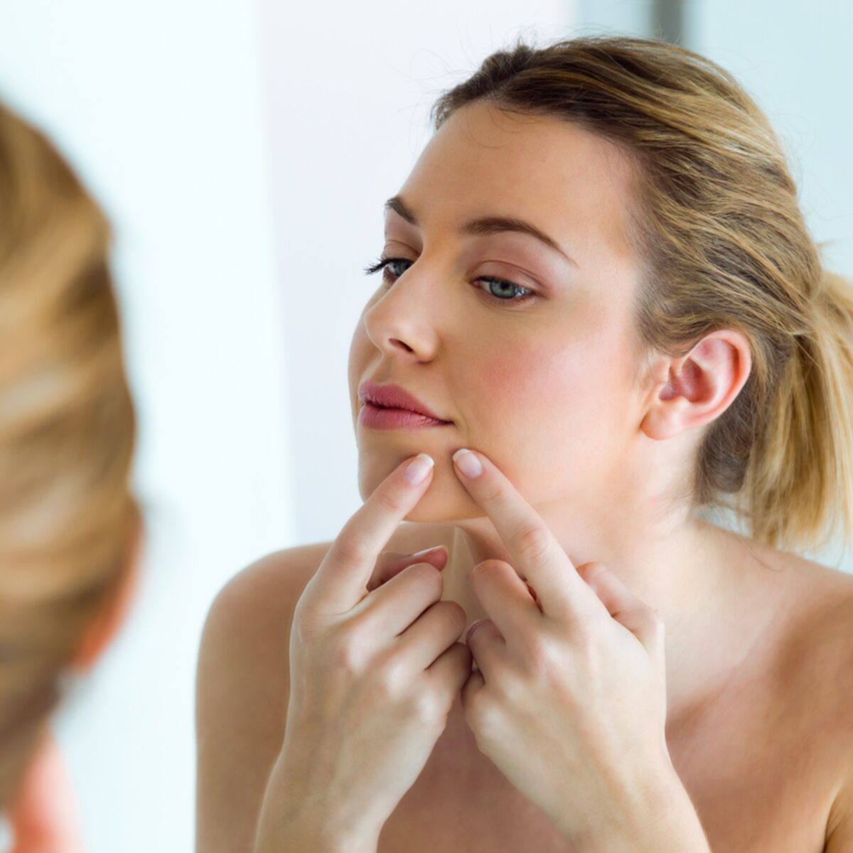 Pilule Contre Roaccutane