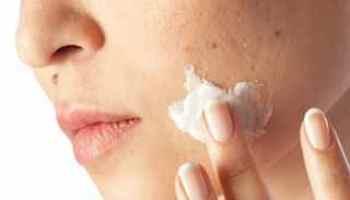 Acheter Roaccutane Gel Sans Ordonnance