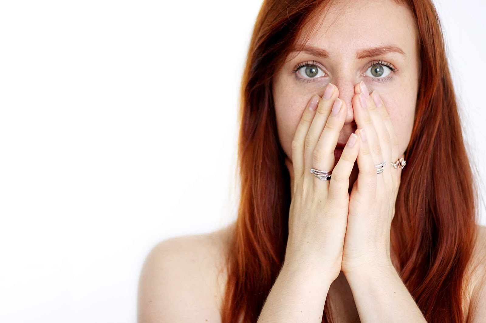 Peut on avoir accutane sans ordonnance