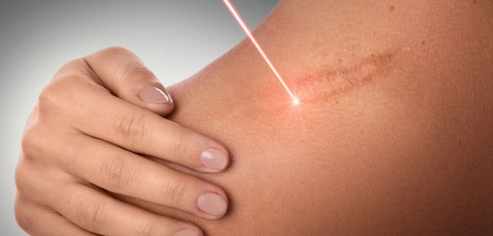 Roaccutane creme prix